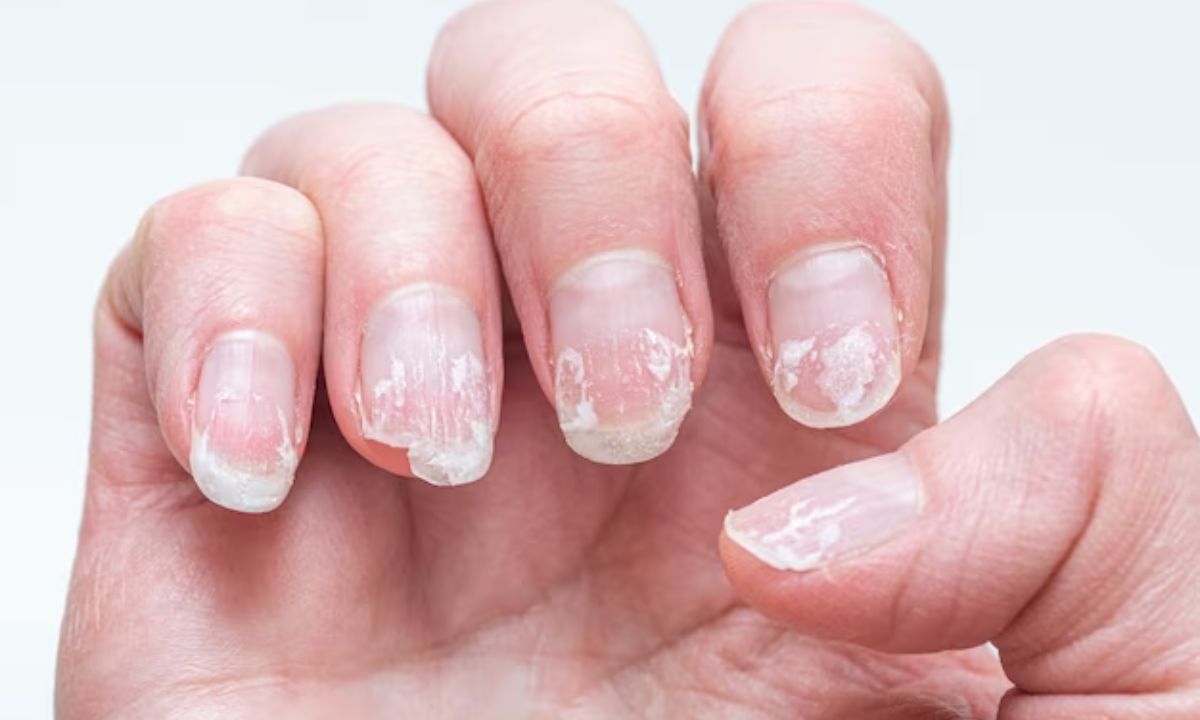 Common Nail Mistakes