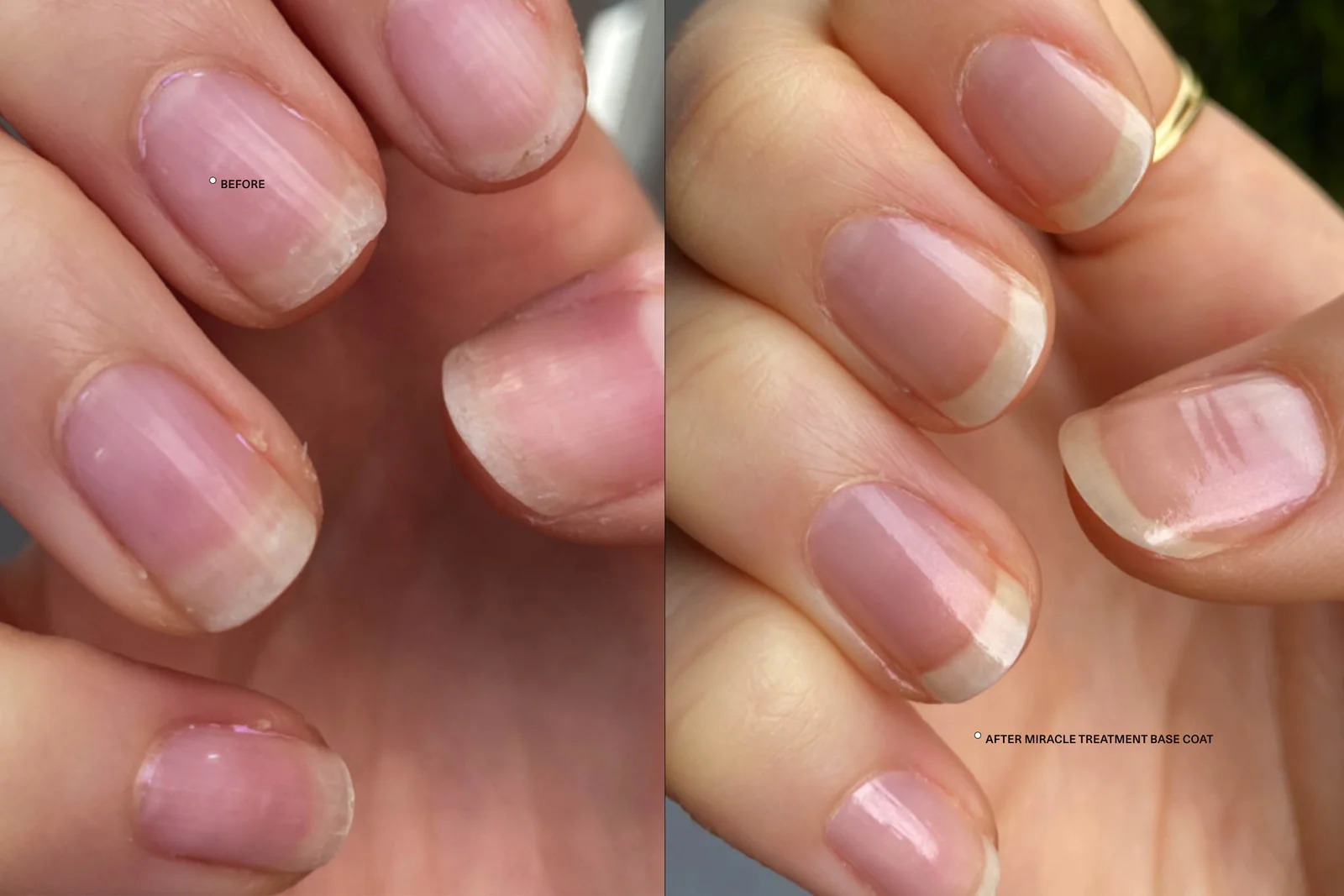 How to Strengthen Weak or Damaged Nails Naturally