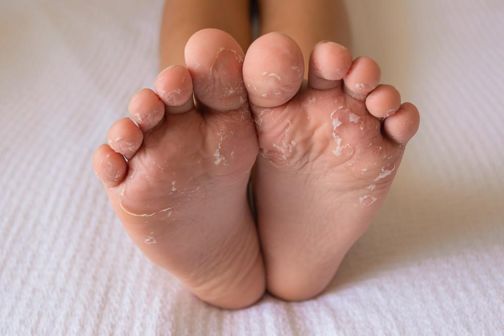 Why Hand and Foot Exfoliation Matters More Than You Think